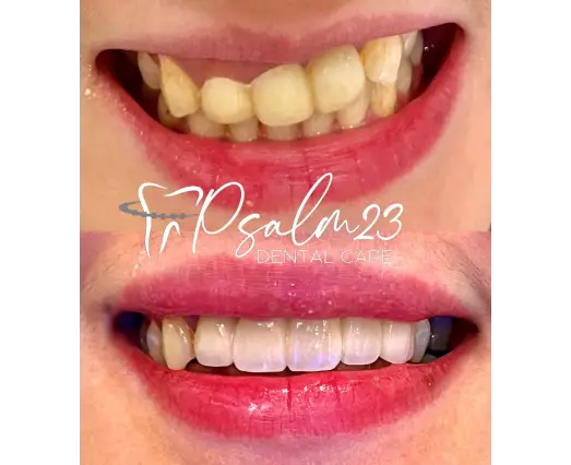 Cosmetic Dentistry Treatment Layout
