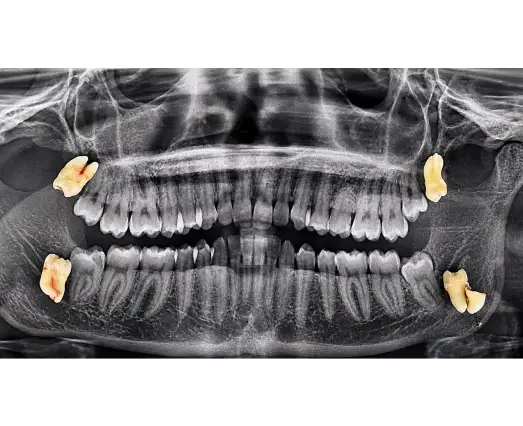 Oral Surgery Care Layout