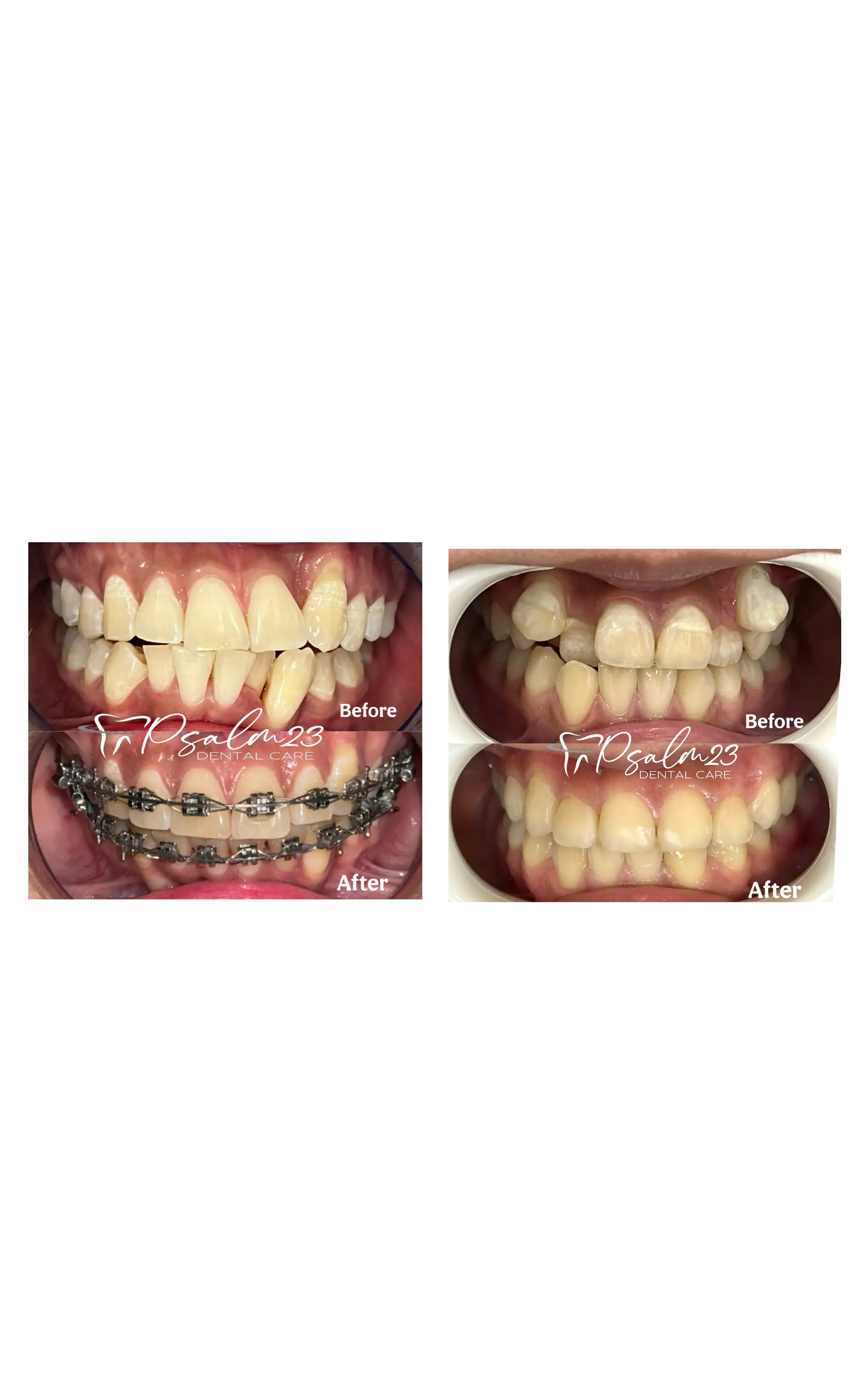 Orthodontics Treatment Layout