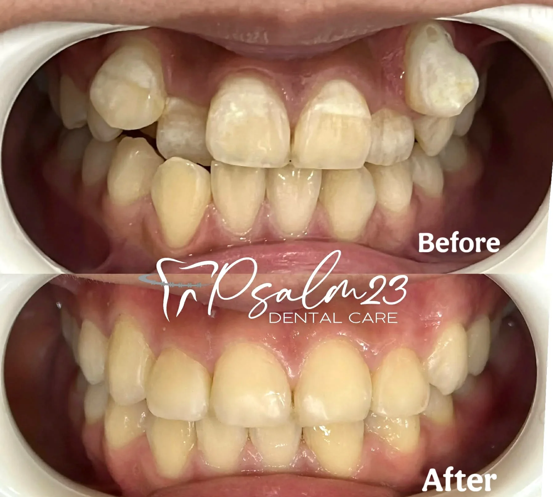Psalm23 Dental Care orthodontic services — photo 1