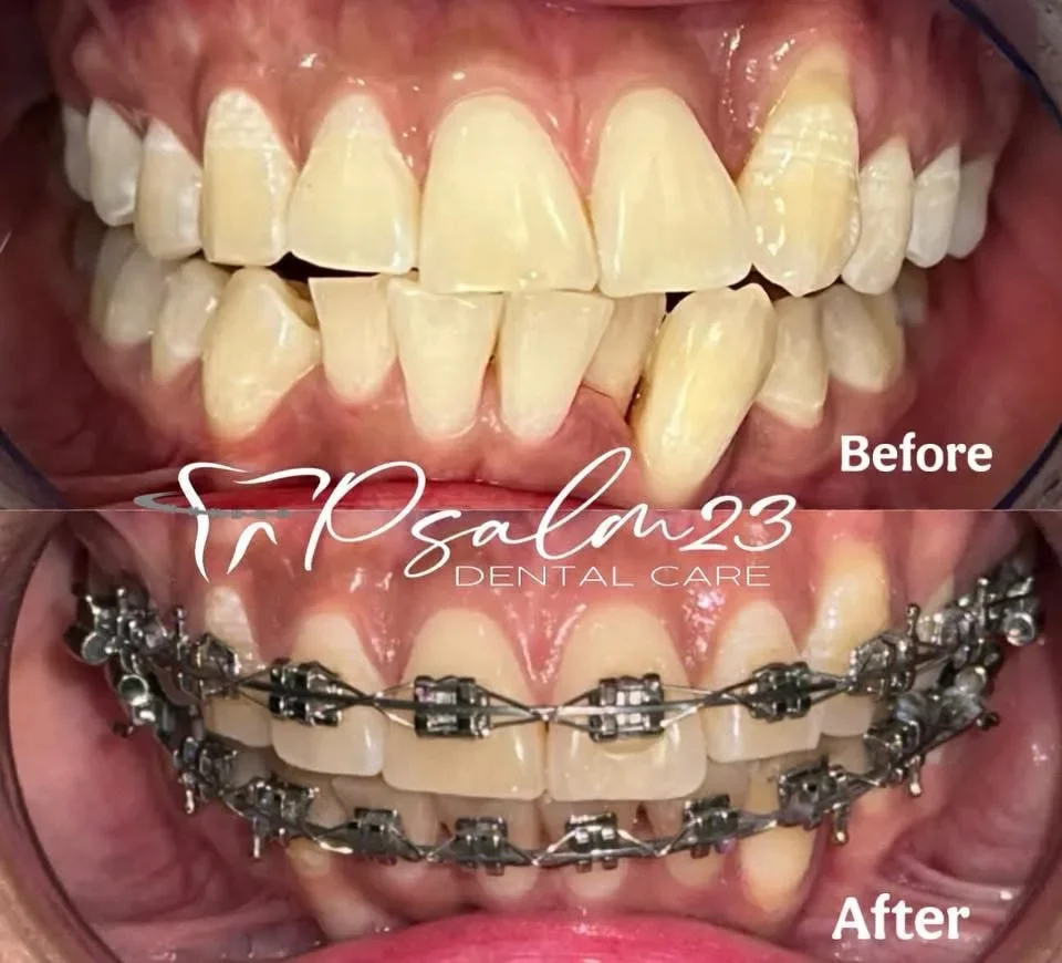 Psalm23 Dental Care orthodontic services — photo 2