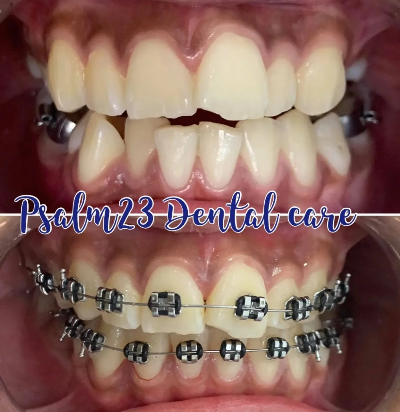 Psalm23 Dental Care orthodontic services — photo 3
