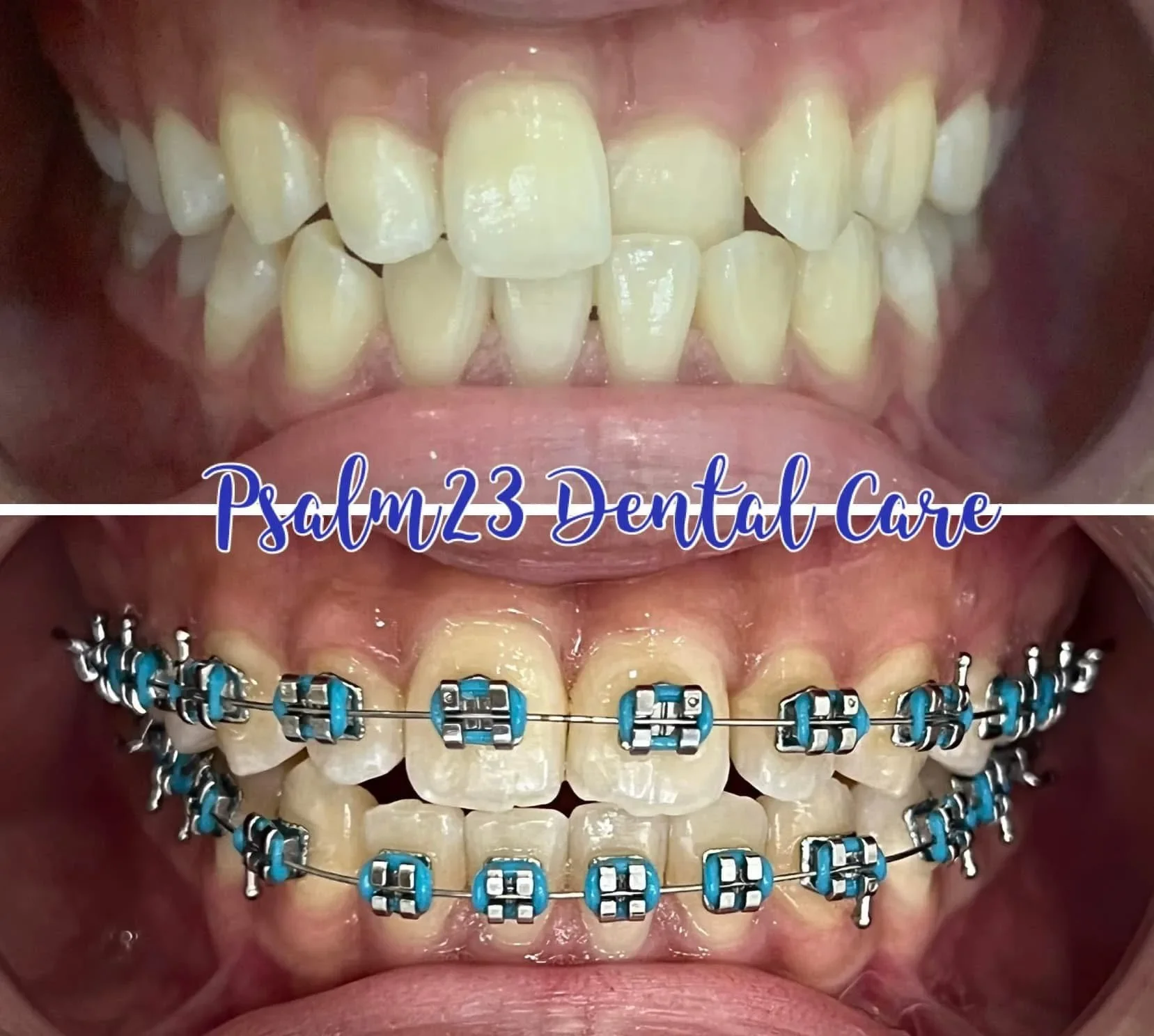 Psalm23 Dental Care orthodontic services — photo 4