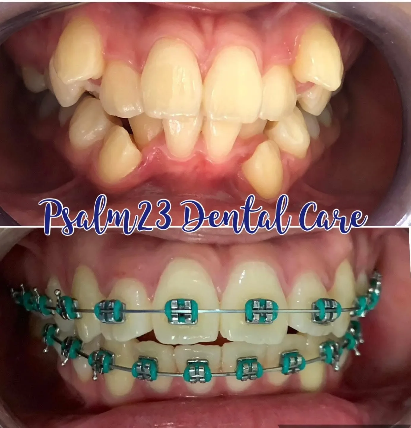 Psalm23 Dental Care orthodontic services — photo 5