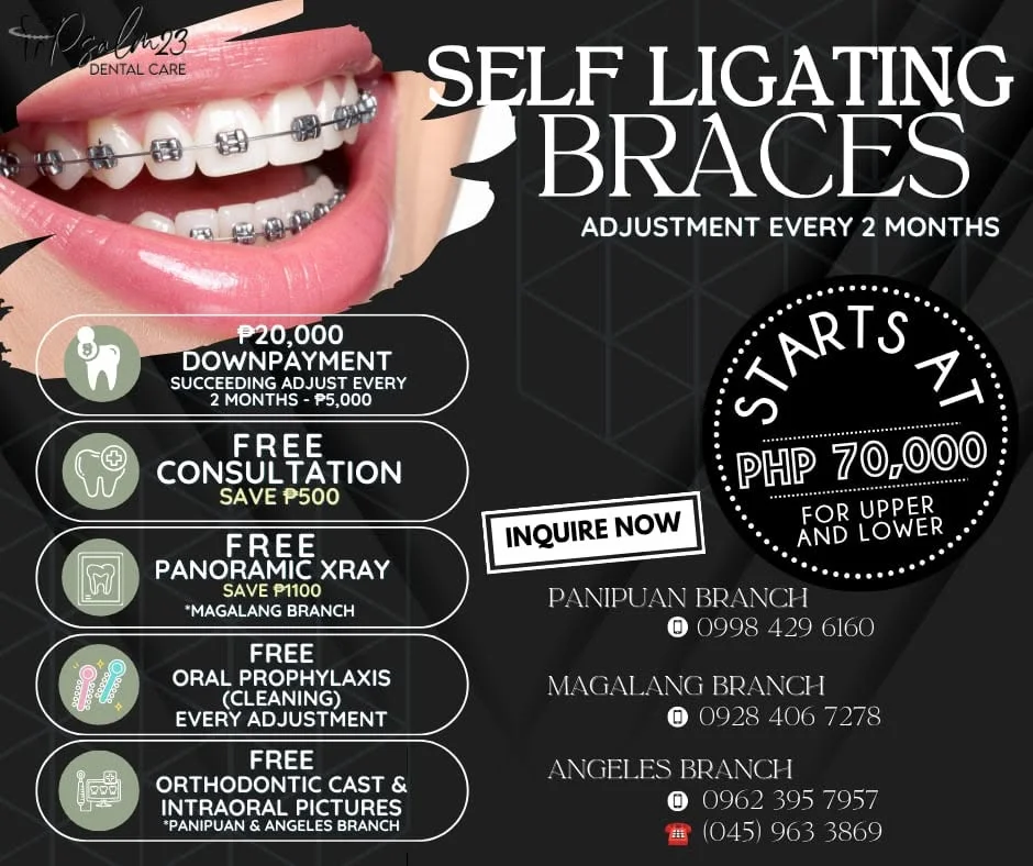 Self Ligating Braces Promo