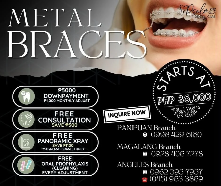 Metal Braces Promo